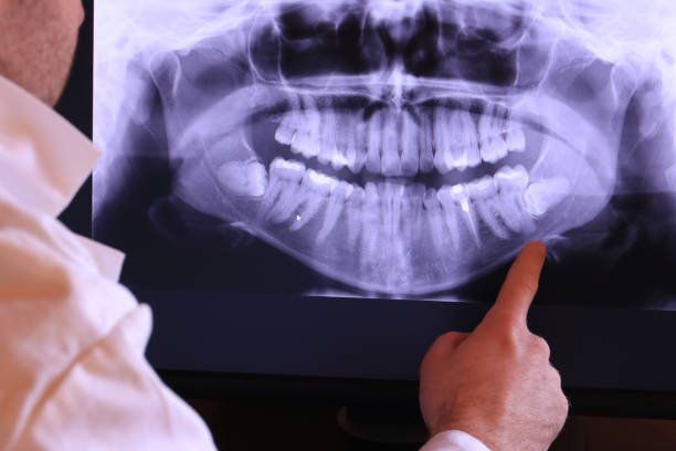 Best Emergency Treatment for Dental Infections or Abscesses in Plum, PA
